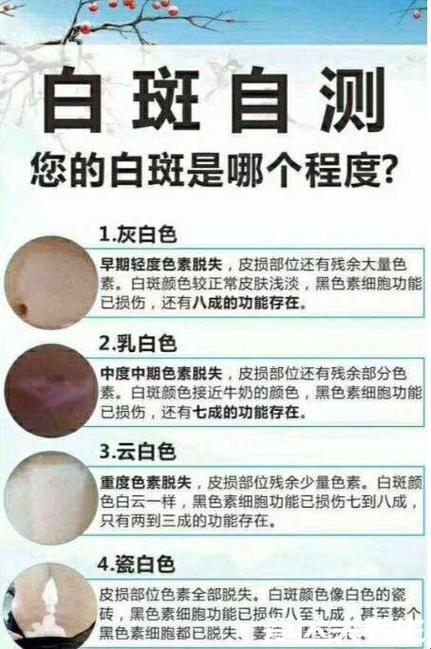 白斑瓷白色，能否妙手回春？