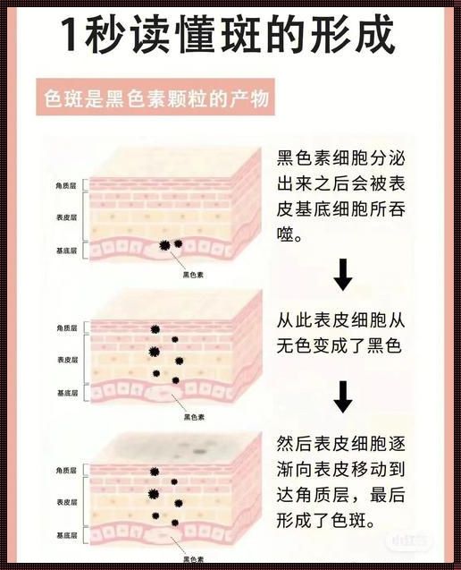 点雀斑，笑谈间的魔法瞬间