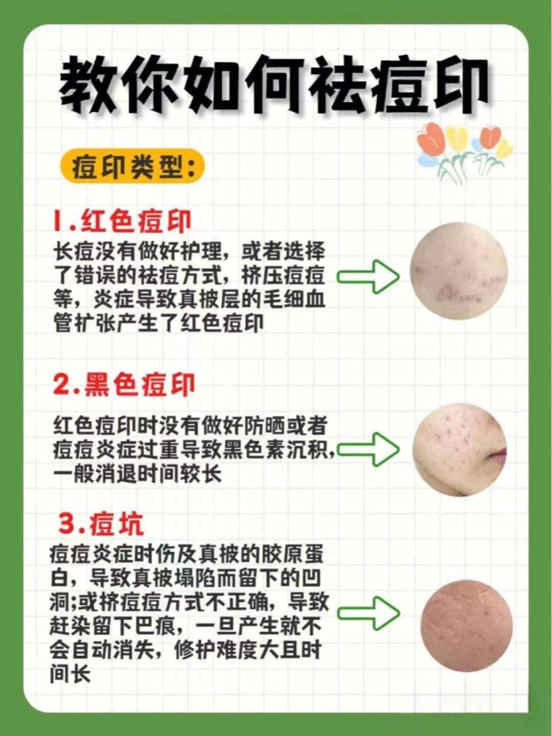 战痘印记攻略：另类方法论