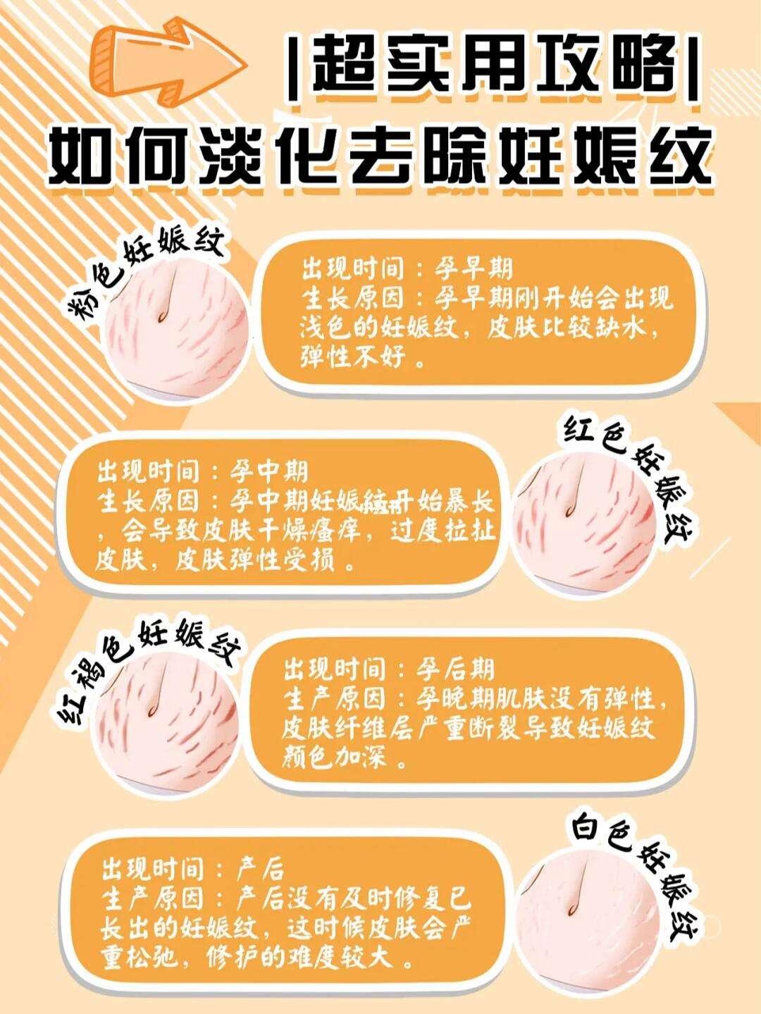 妊娠纹长征记：如何逆袭成肚皮界的艺术品