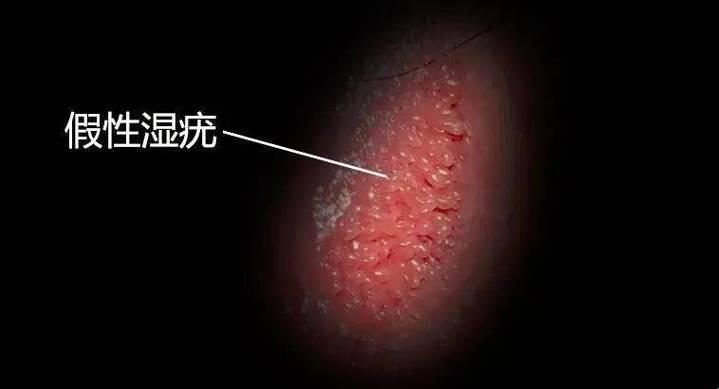 “私密”地带遭遇“青春痘”逆袭，笑泪之间求解方