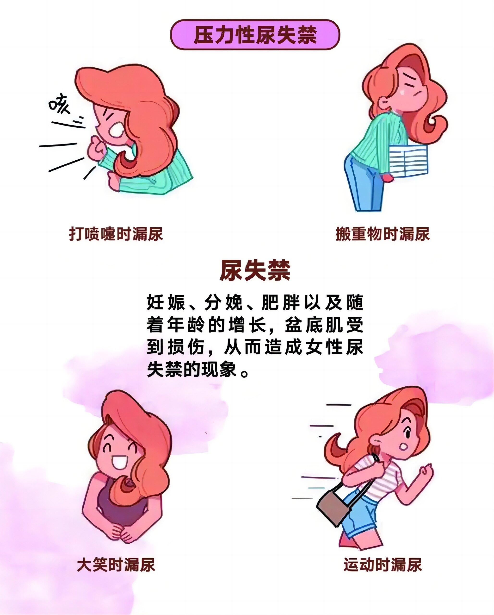 "排泄自主权"风波：女性身体自由的奇妙战争