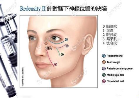 熊猫眼眶打“美容针”？笑谈安全性